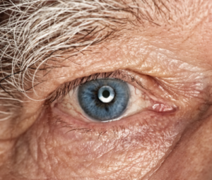 Old person eye